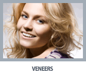 Veneers