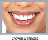 Crowns and Bridges